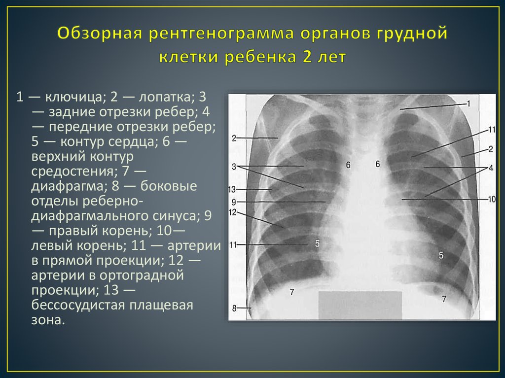 Что значит снимок. Обзорная рентгенограмма органов грудной клетки. Обзорная рентгенограмма грудной клетки. Рентген снимки грудной клетки норма. Обзорный рентген органов грудной клетки.