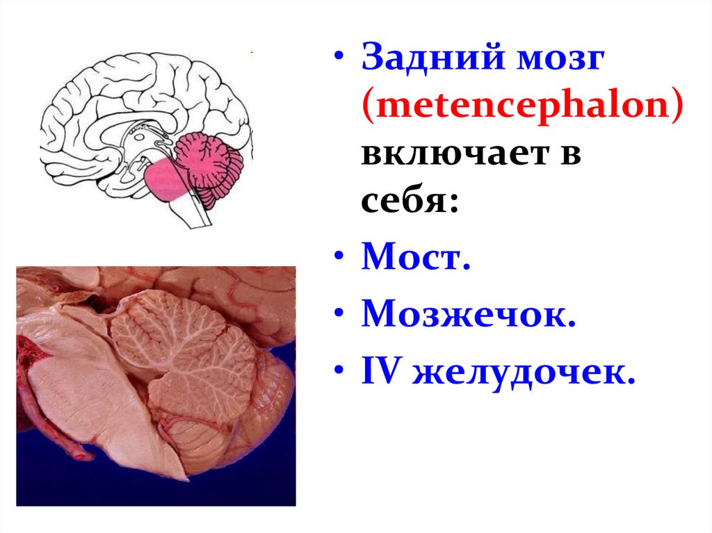 Задний мозг презентация