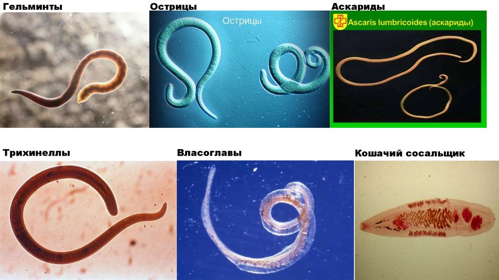 Какие черви живут в человеке фото