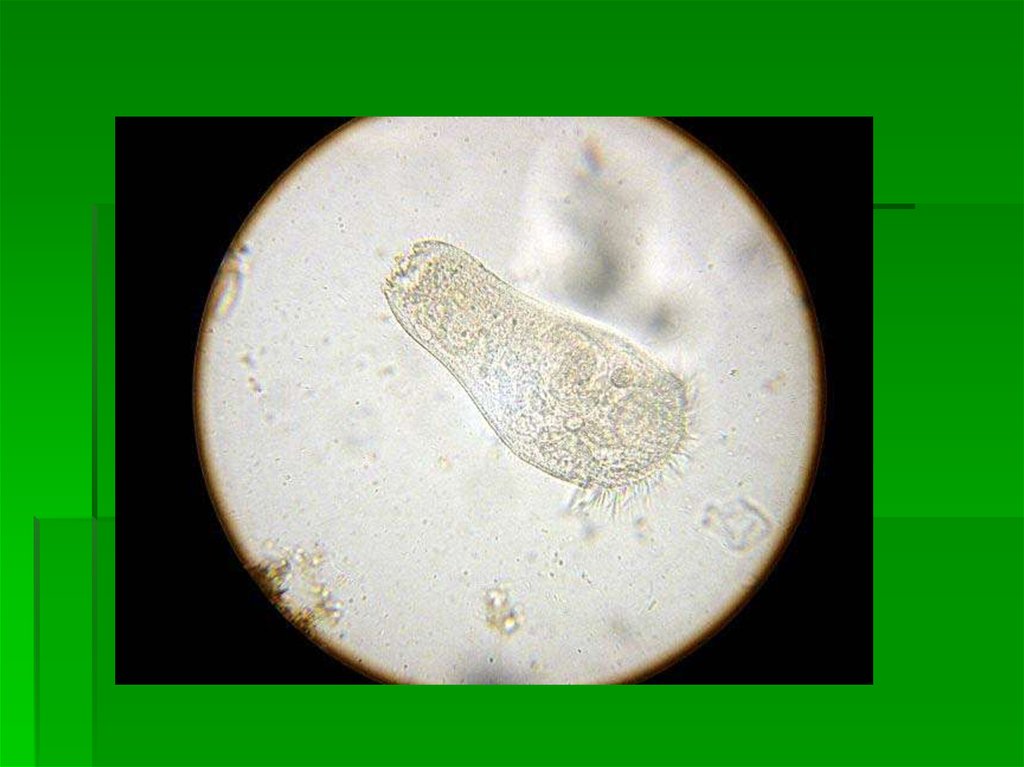 Микроскоп животное. Инфузория туфелька в микроскопе. Инфузория в микроскопе. Инфузория через микроскоп. Инфузория туфелька через микроскоп.