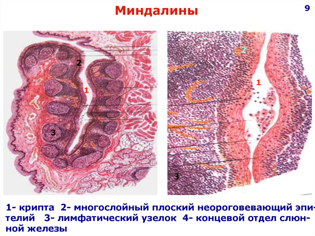 Миндалина гистология рисунок