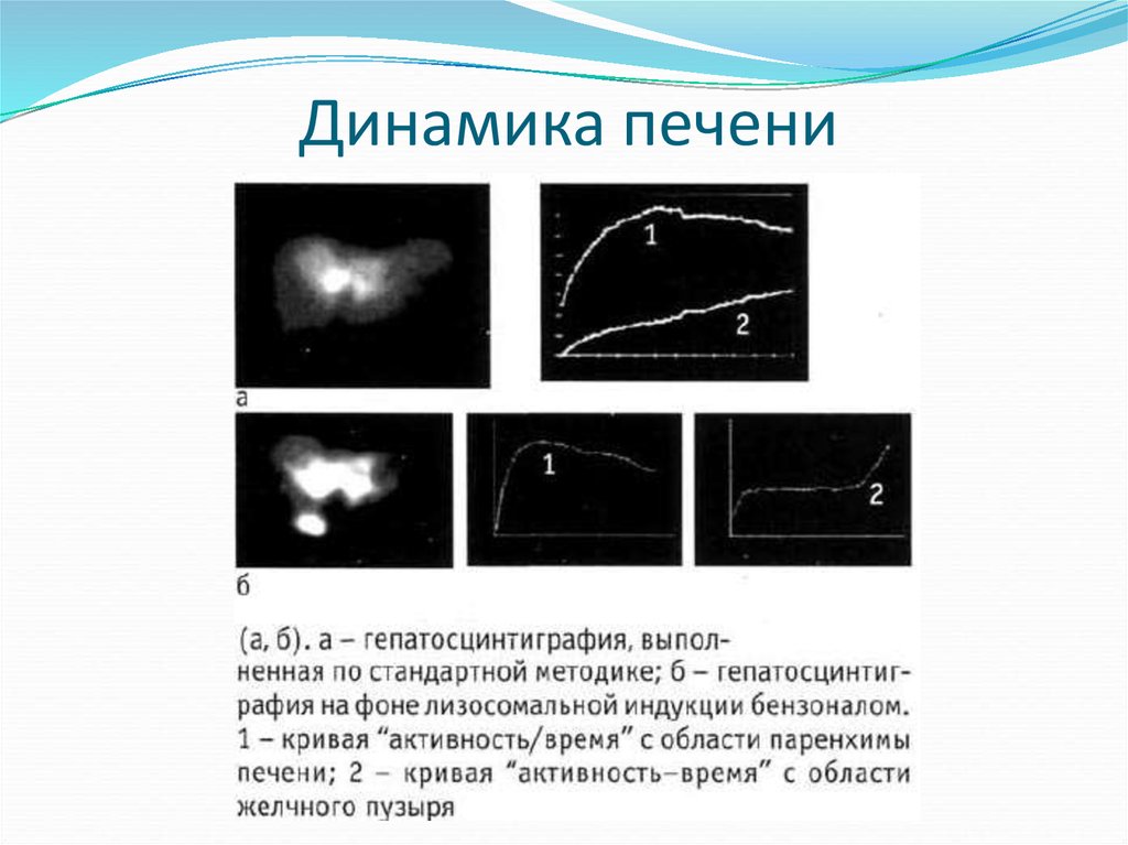 Подготовка печени. Гепатосцинтиграфия печени. Радиоизотопные исследования печени презентация. Образование печени динамик акт. Радиоизотопная диагностика меланомы.