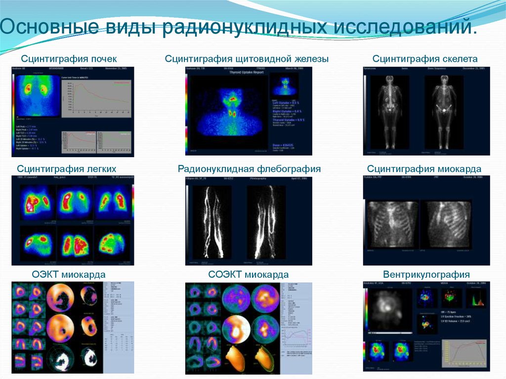 Радионуклидная диагностика фото