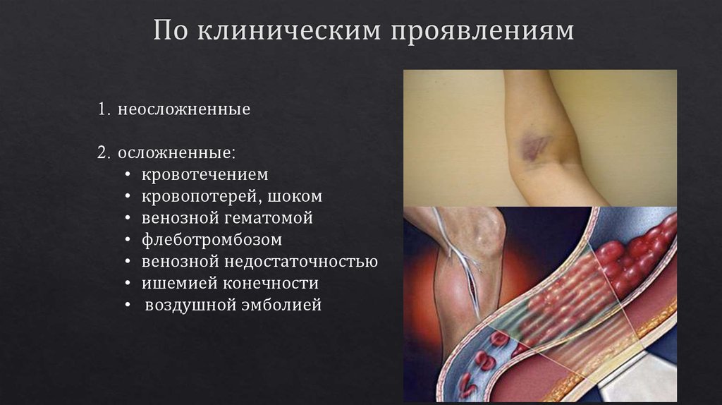 По клиническим проявлениям