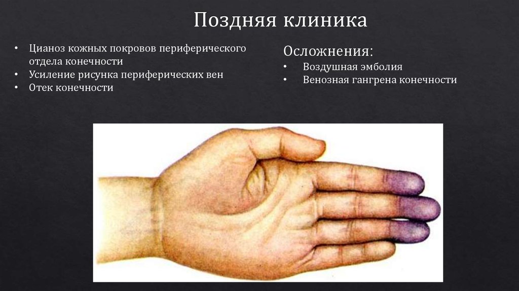 Лечение повреждений вен. Методы восстановления - презентация онлайн