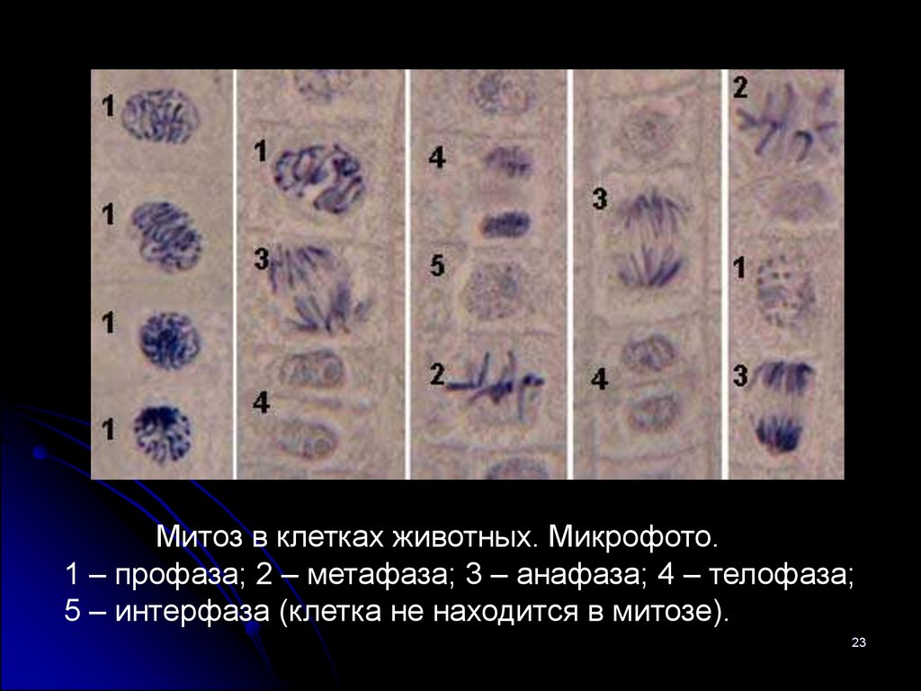 Микрофотографии митоза. Фазы митоза в микроскопе. Профаза метафаза анафаза телофаза гистология. Телофазе i метафазе i профазе i анафазе i.