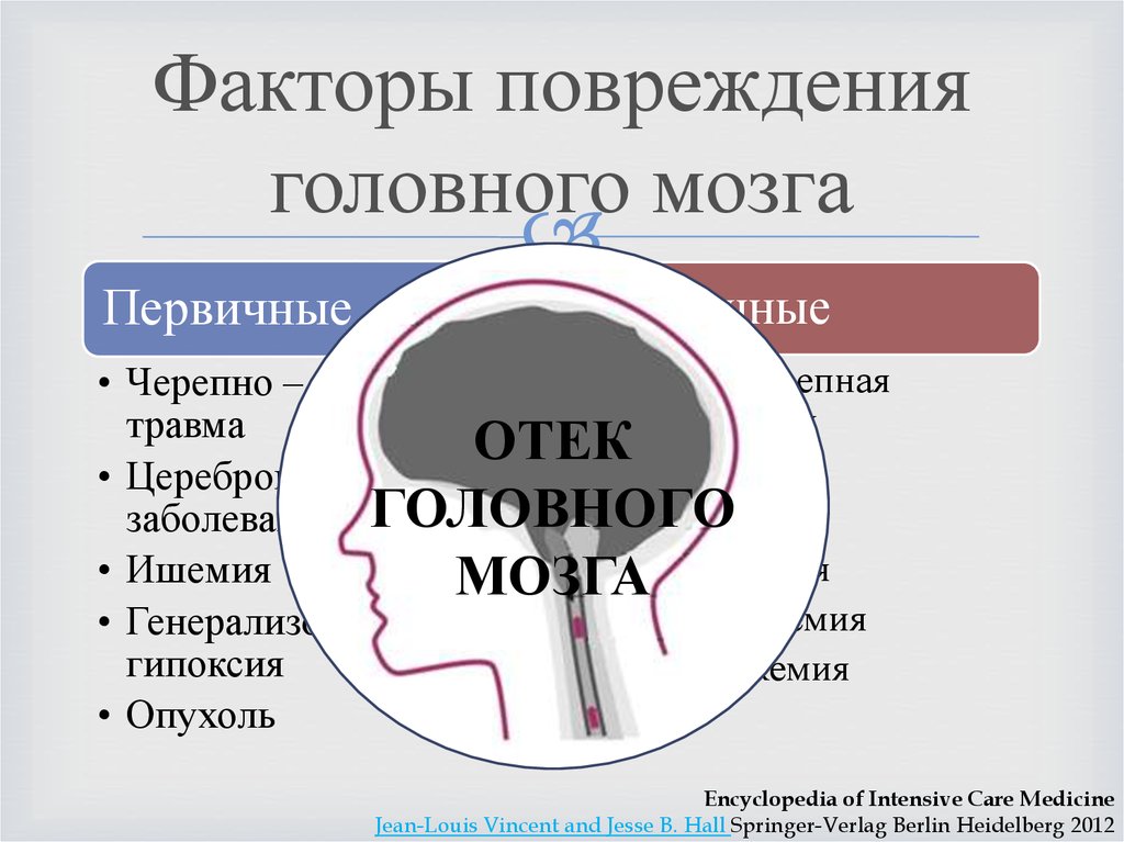 Смерть мозга презентация