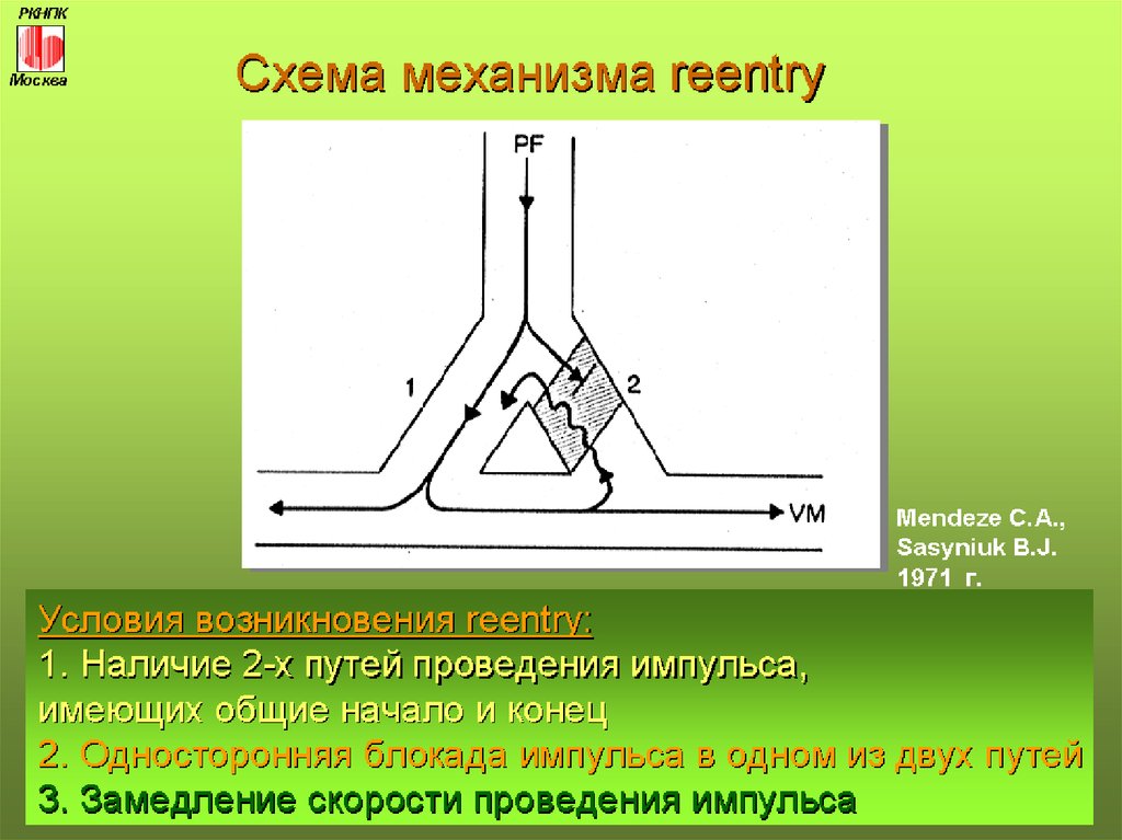 Условия механизма. Механизм риентри аритмий. Механизм re-entry схема. Механизм Ри энтри это. Механизм Ре-энтри схема.