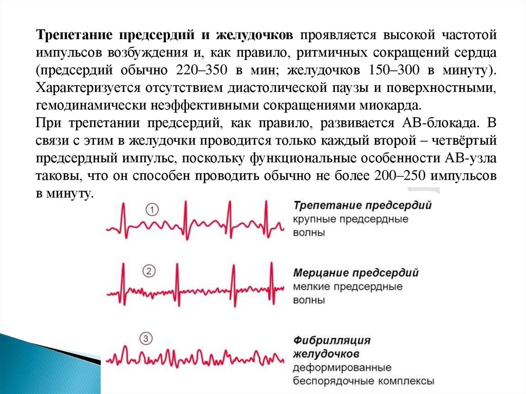 Нарушение возбудимости миокарда