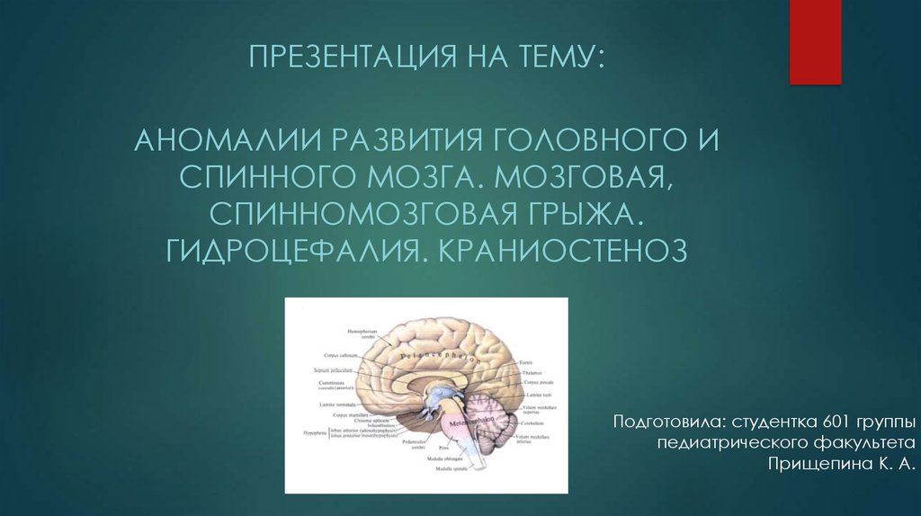 Нарушение развития головного мозга. Пороки развития головного мозга. Аномалии развития головного мозга. Аномалии развития головного и спинного мозга. Пороки развития головного мозга у плода.