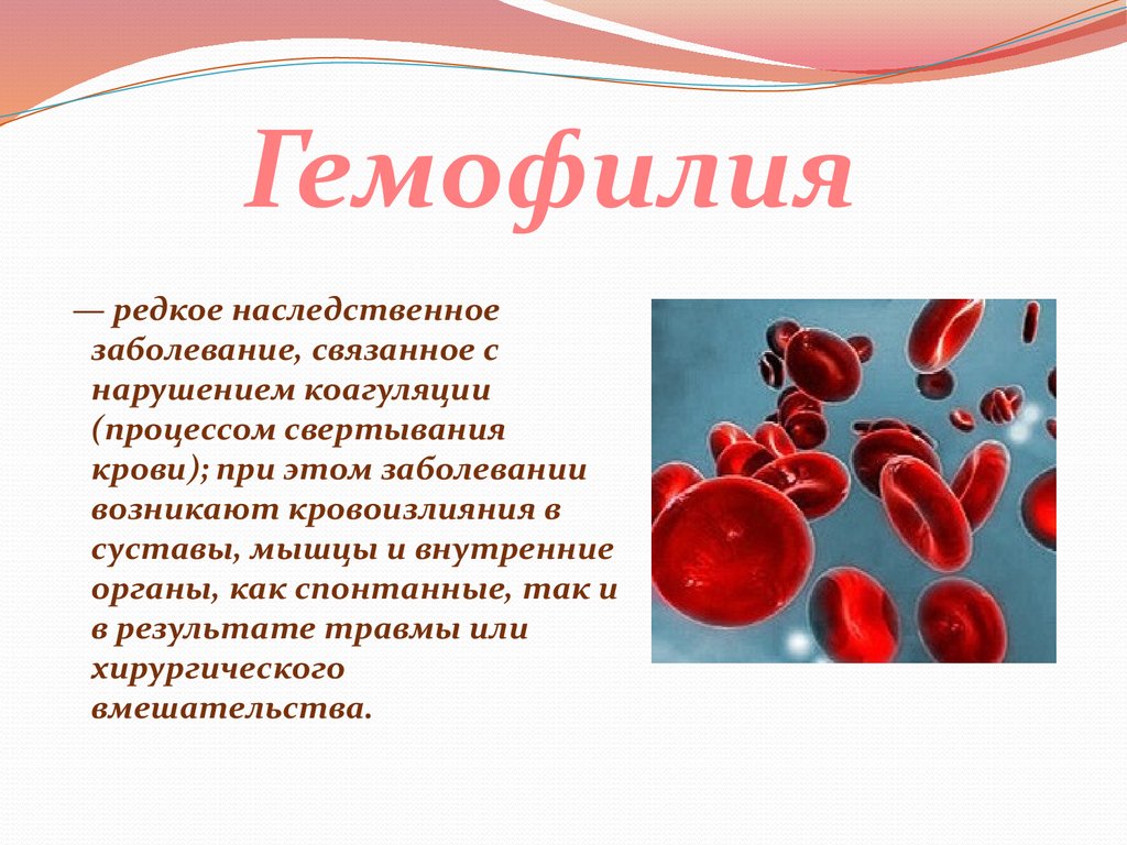 Болезни крови у мужчин. Наследственная болезнь нарушения свертываемости крови. Гемофилия и заболевание крови. Наследственные нарушения свертываемости крови.