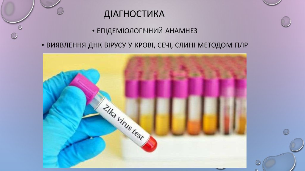 діагностика