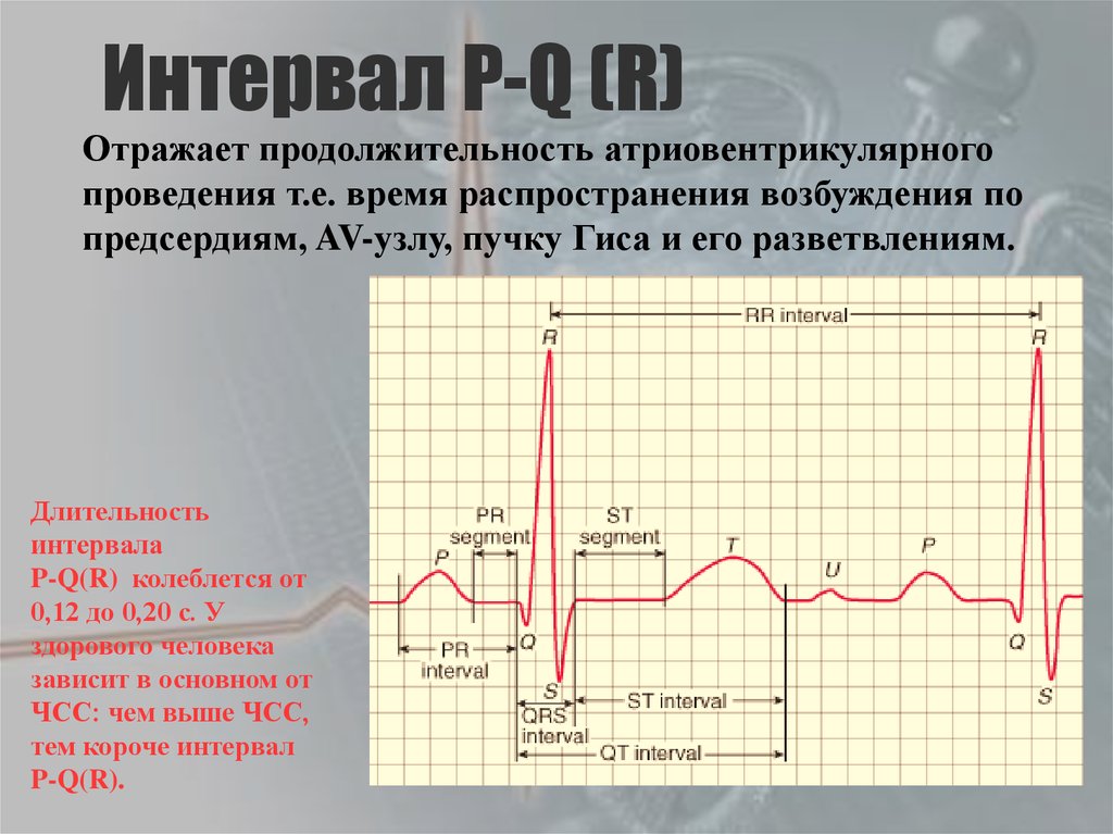 Pq на экг. Интервал PQ на ЭКГ. Интервал р q на ЭКГ. Продолжительность интервала PQ на ЭКГ. Длительность PQ на ЭКГ.