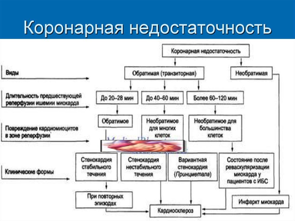 Коронарная недостаточность презентация