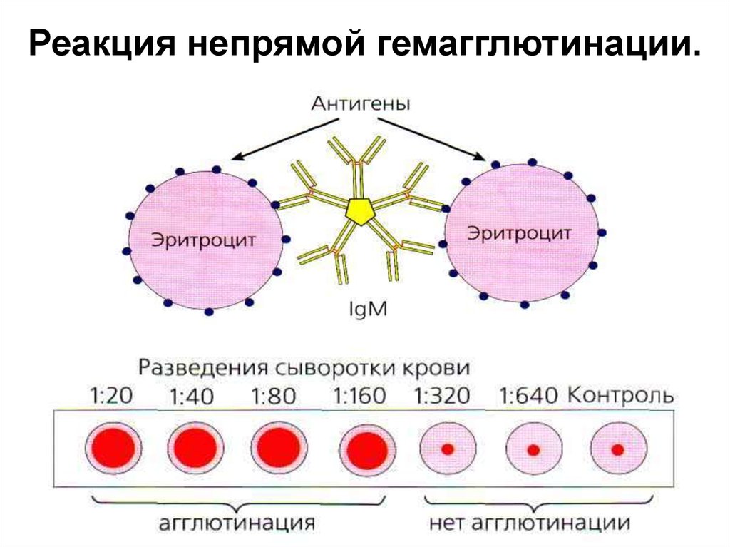 Исследование антигенов. Реакция непрямой (пассивной) гемагглютинации (РНГА, РПГА). Реакция непрямой гемагглютинации (РНГА). Реакция непрямой (пассивной) гемагглютинации (РНГА). Положительный результат реакции непрямой гемагглютинации.