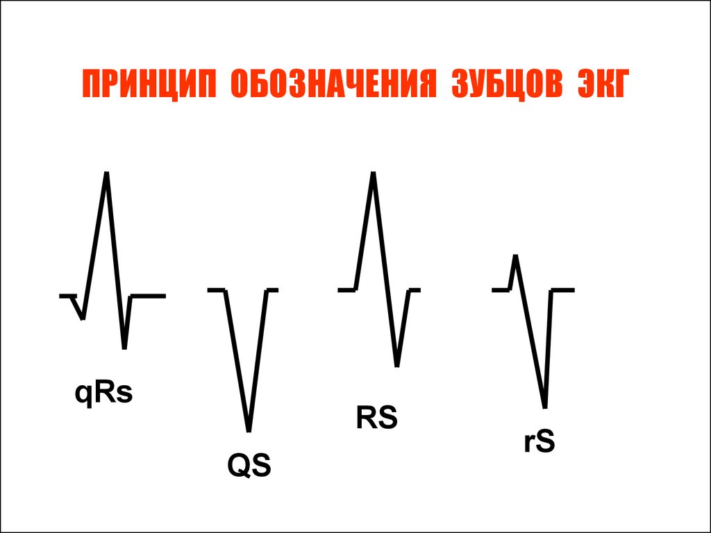 Экг 6. Обозначение зубцов на ЭКГ. Маркировка ЭКГ. Кардиограмма обозначения. QS Тип ЭКГ.