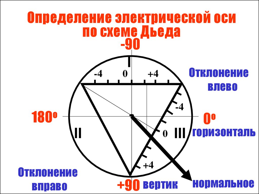 Электрическая ось сердца отклонена влево