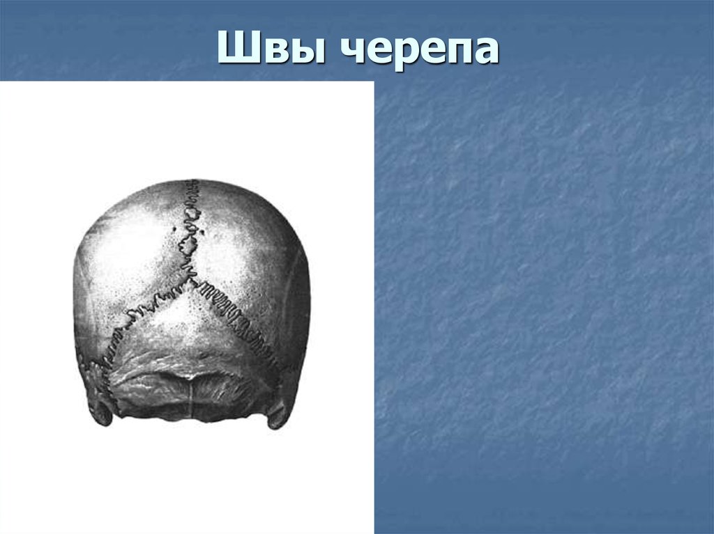 Швы черепа. Сагиттальный шов черепа анатомия. Сагиттальный шов черепа латынь. Зубчатые швы между костями мозгового черепа.