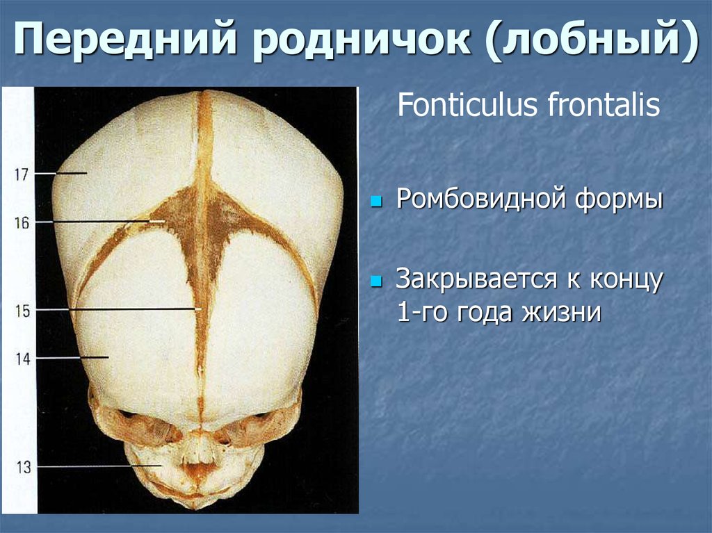 Роднички доношенного ребенка. Кости черепа роднички. Роднички черепа новорожденных. Сосцевидный Родничок черепа. Метопический шов черепа.