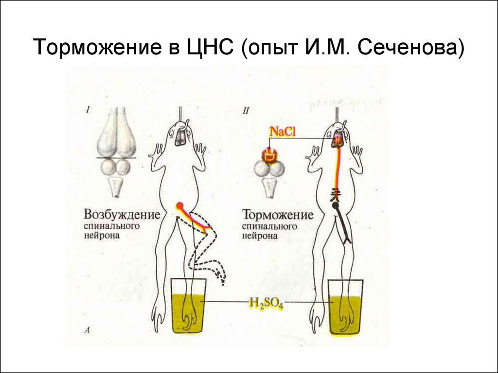 Возбуждение нервов. Опыт Сеченова с лягушкой центральное торможение. Опыт Сеченова торможение спинальных рефлексов. Центральное торможение опыт Сеченова физиология. Торможение рефлексов опыт и.м Сеченова.