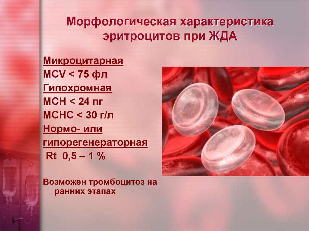 Цветовой показатель эритроцитов. MCH при гипохромной анемии это. Микроцитарная анемия показатели эритроцитов. Эритроциты при микроцитарная анемия. Морфологические изменения эритроцитов при железодефицитной анемии.