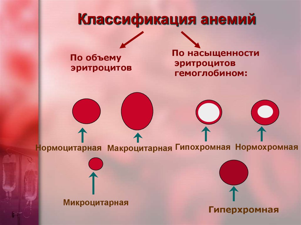 Анемия на фоне онкологии