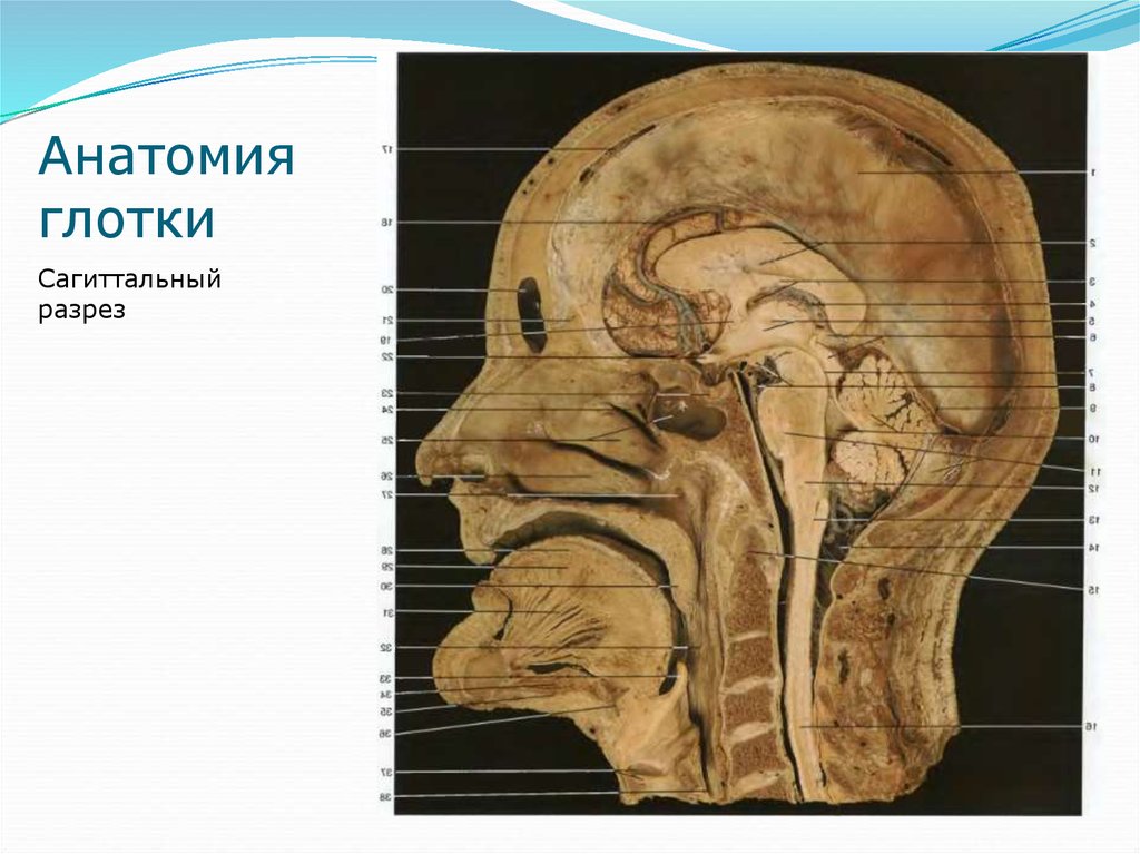 Раскройте голову. Распил головы анатомия. Глотка препарат анатомия. Сагиттальный распил головы анатомия препарат. Сагиттальный разрез головы препарат.