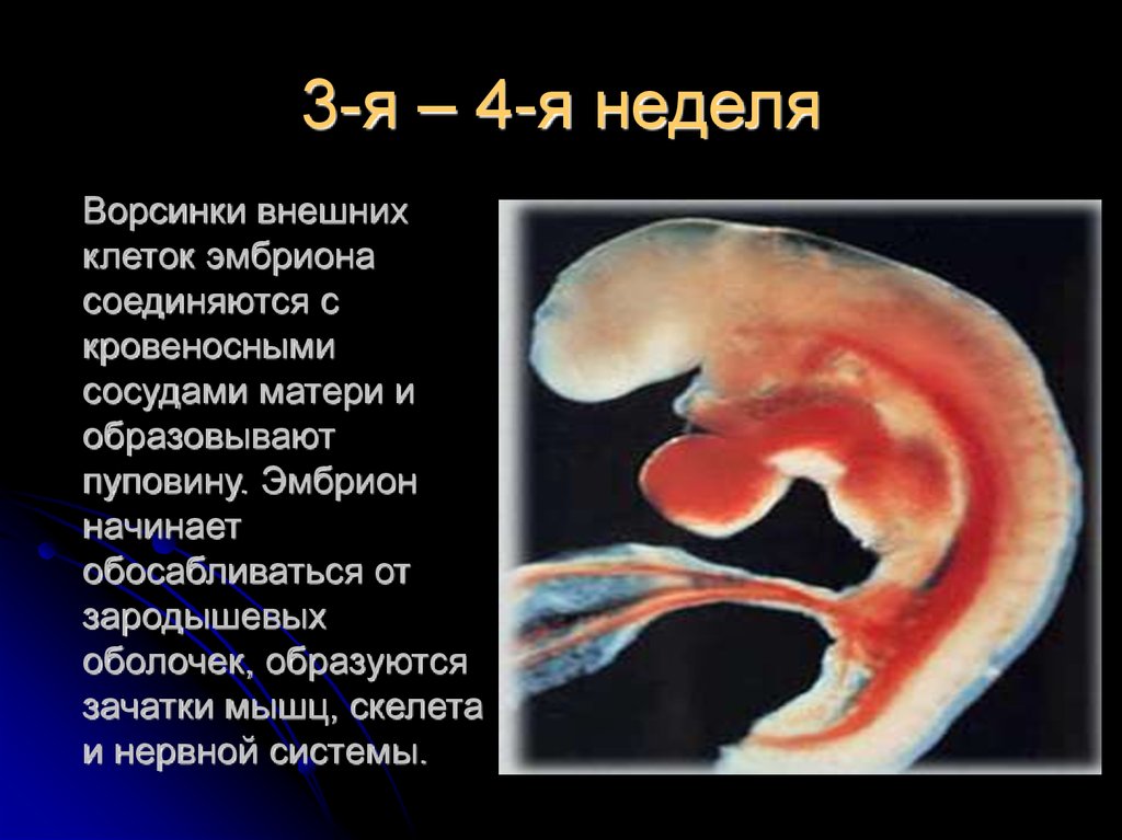 Что происходит на 3 неделе. Как выглядит зародыш в 3-4 недели. Формирование эмбриона в 4 недели беременности. Эмбрион человека 3-4 недели.