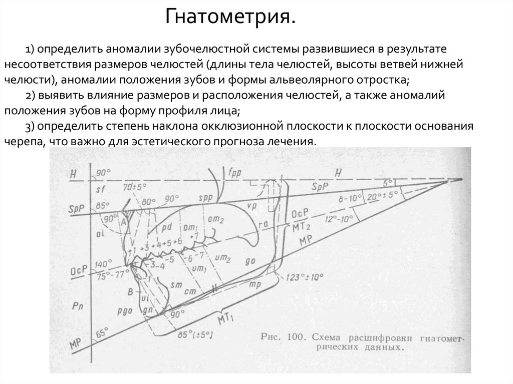 Угол spp mp. Гнатометрия. Гнатометрия в ортодонтии. Окклюзионная плоскость на ТРГ. ТРГ угол наклона окклюзионной плоскости.