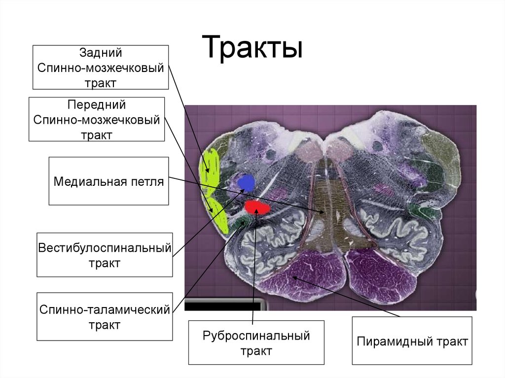 Задний мозг презентация