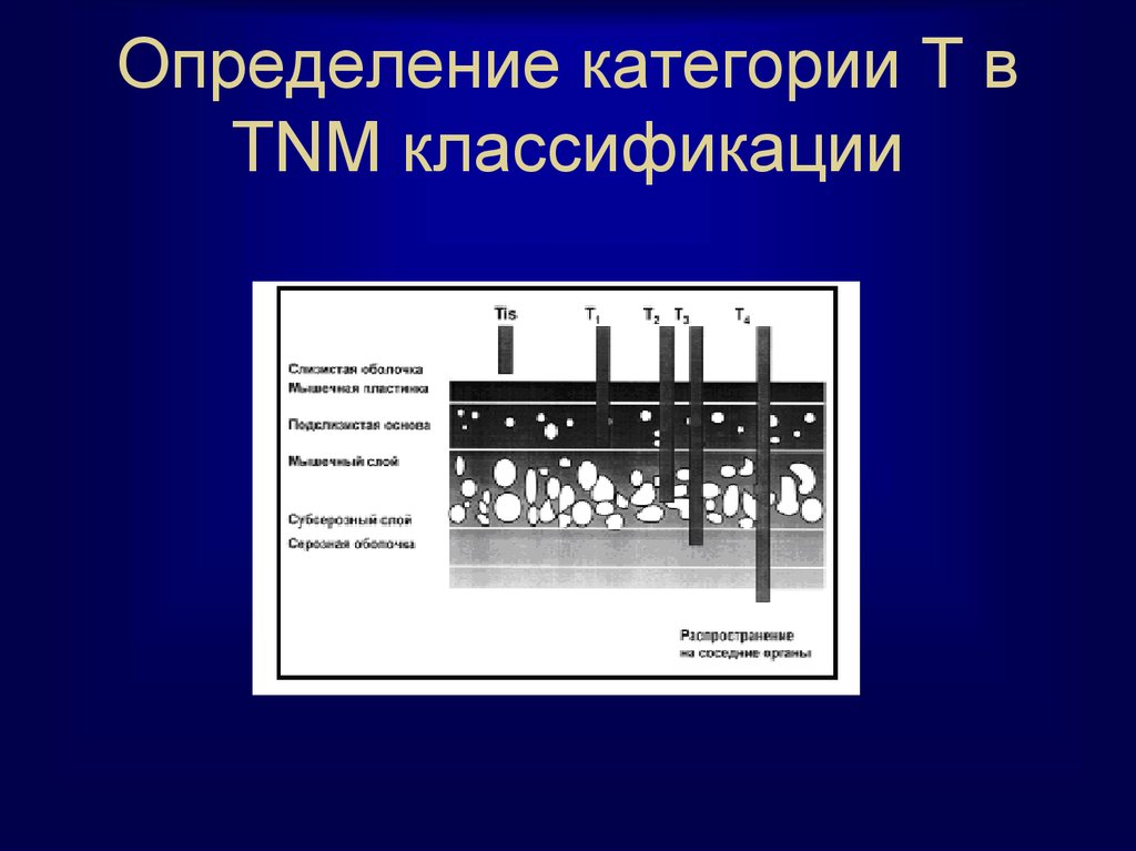 Определите категорию. R В классификации TNM.