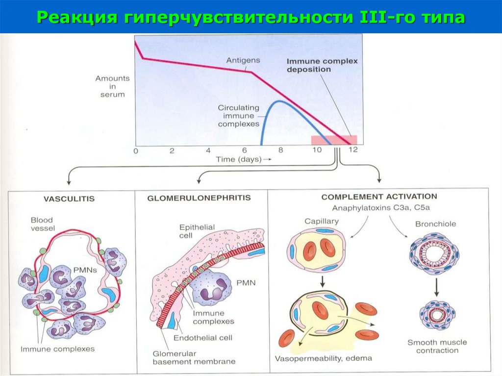 Развитие реакции. Схема реакции гиперчувствительности 3 типа. Механизм развития III –типа гиперчувствительности. Реакция гиперчувствительности 3 типа. 3 Тип гиперчувствительности иммунология.