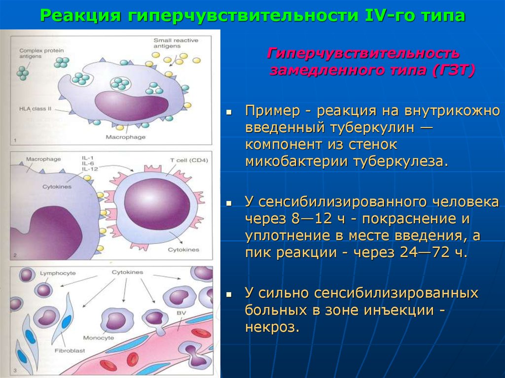 Реакция немедленного типа