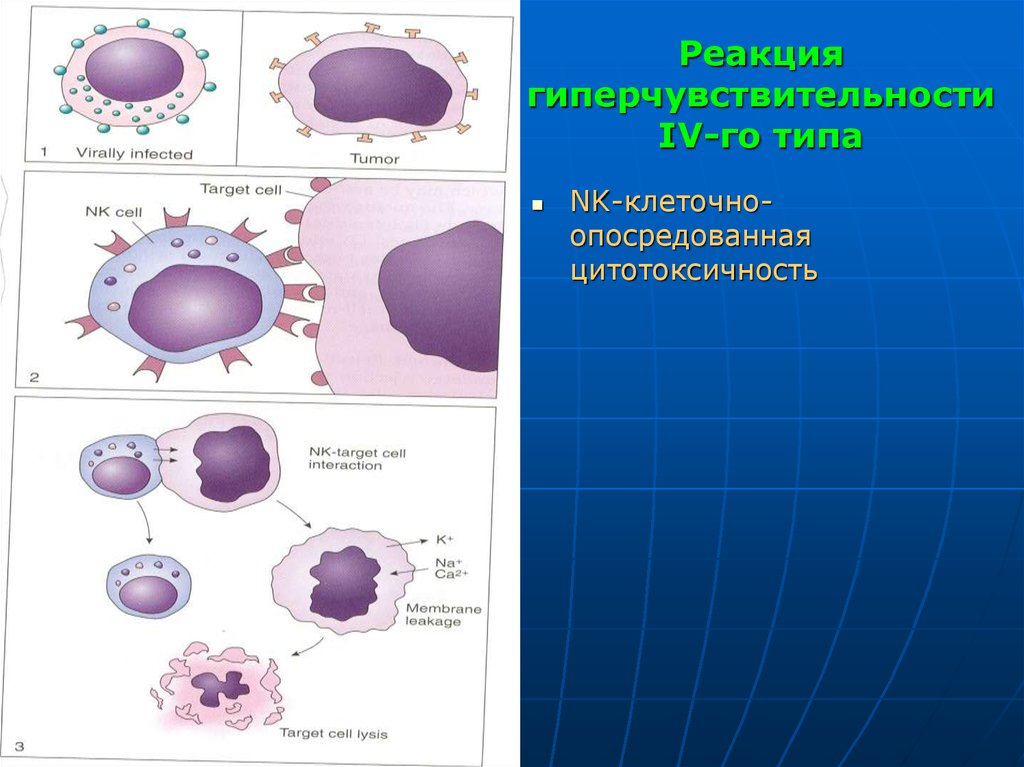 Реакция в тканях. Клеточноопосредованная цитотоксичность. Клеточно опосредованная цитотоксичность. Иммунопатологические процессы патологическая анатомия. Классификация иммунопатологических процессов патанатомия.