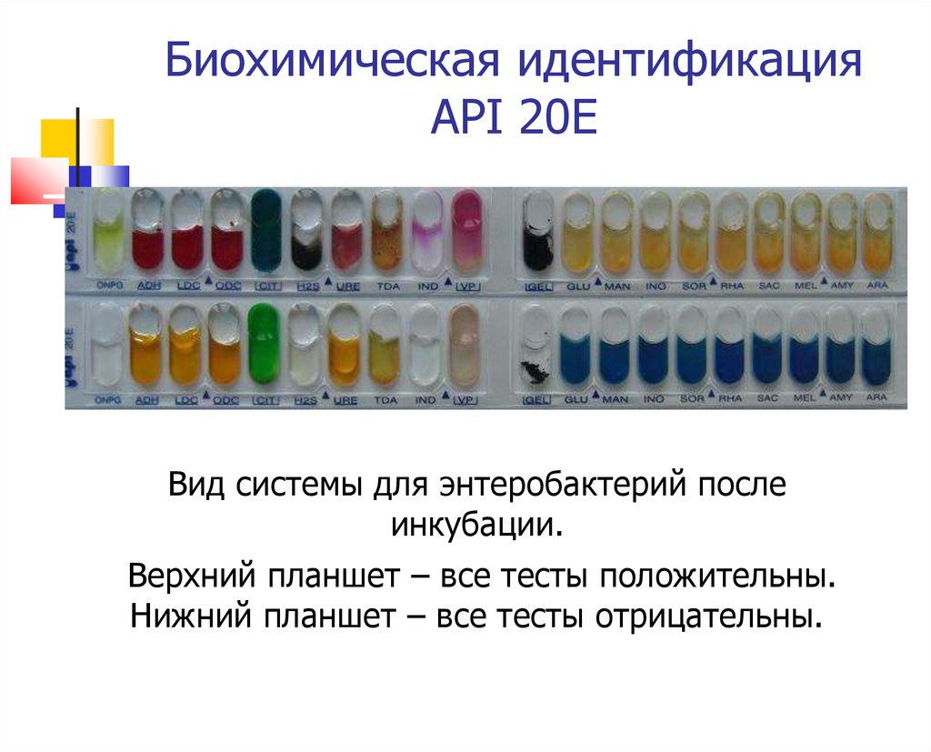 Биохимический вид. Тест системы для биохимической идентификации энтеробактерий. Биохимическая идентификация бактерий. Метод Дригальского выделение чистой культуры.