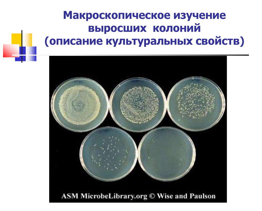 Оценка каких свойств микроорганизмов показана на рисунке