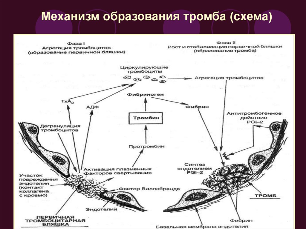 Механизмы тромбов. Механизм образования тромба. Схема образования тромба. Этапы образования тромба схема. Процесс тромбообразования схема.