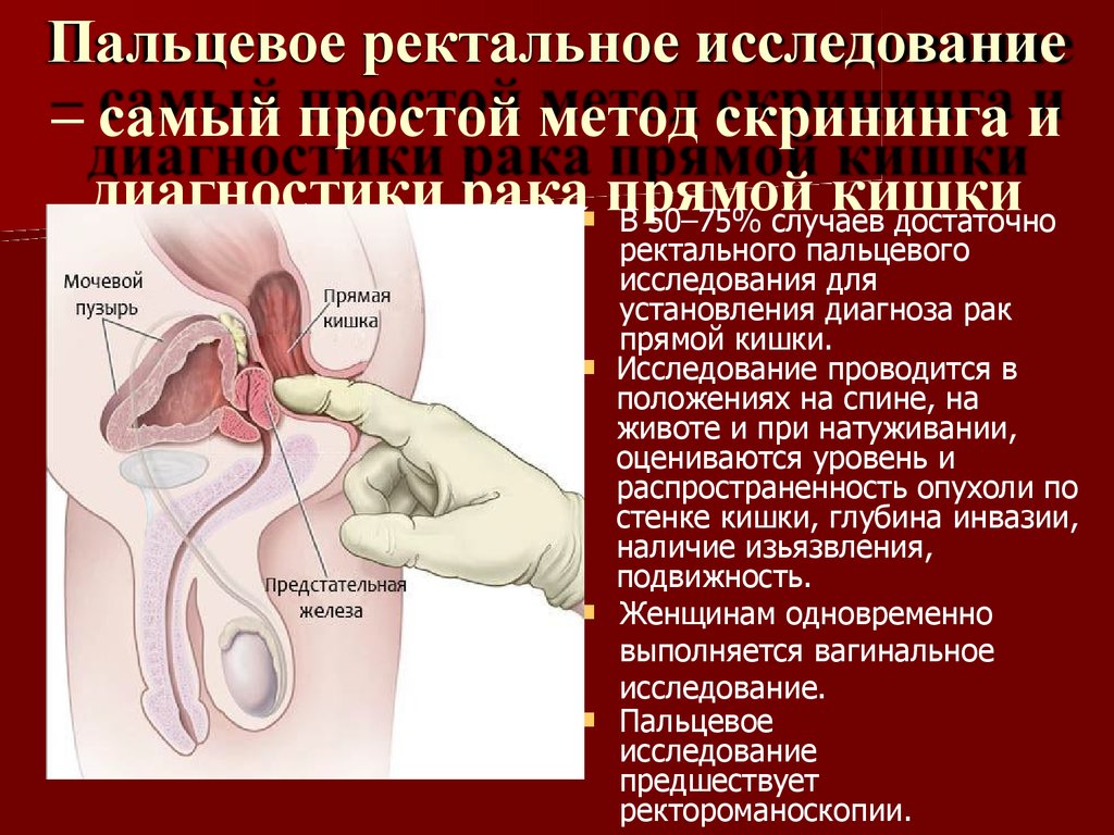 Реферат: Геморрой и колоректальный рак