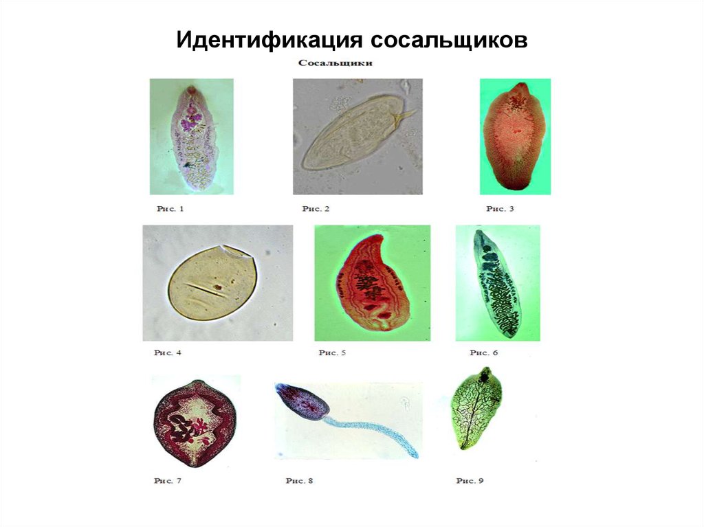 Яйца печеночного сосальщика рисунок