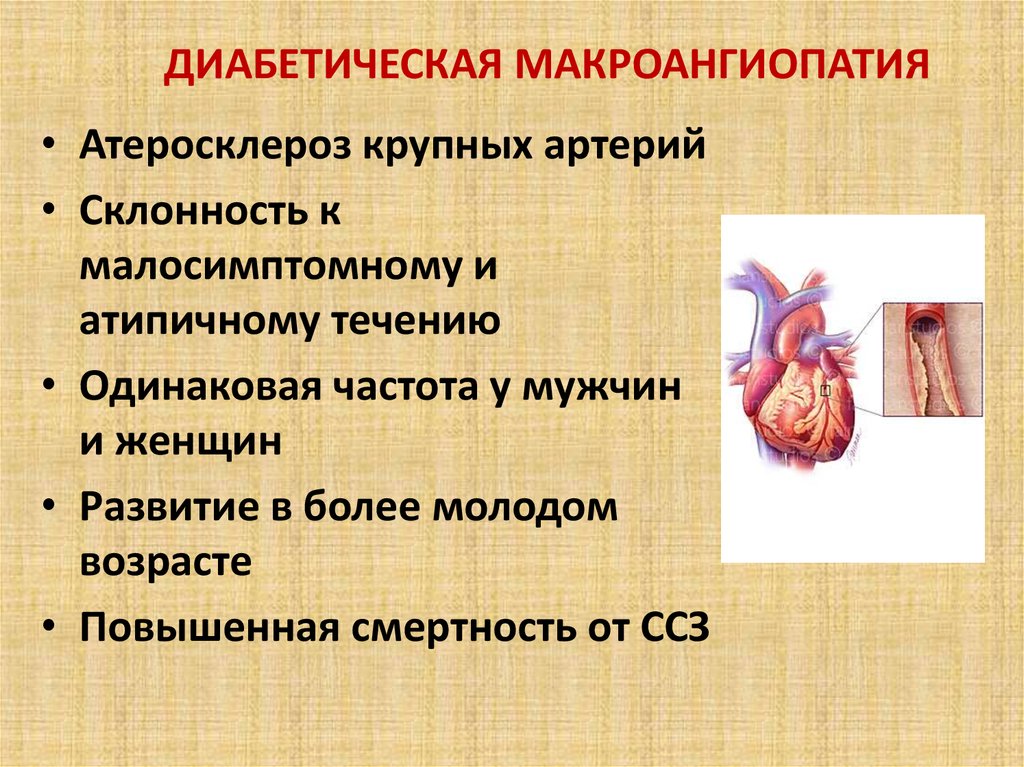 Диабетическая ангиопатия презентация