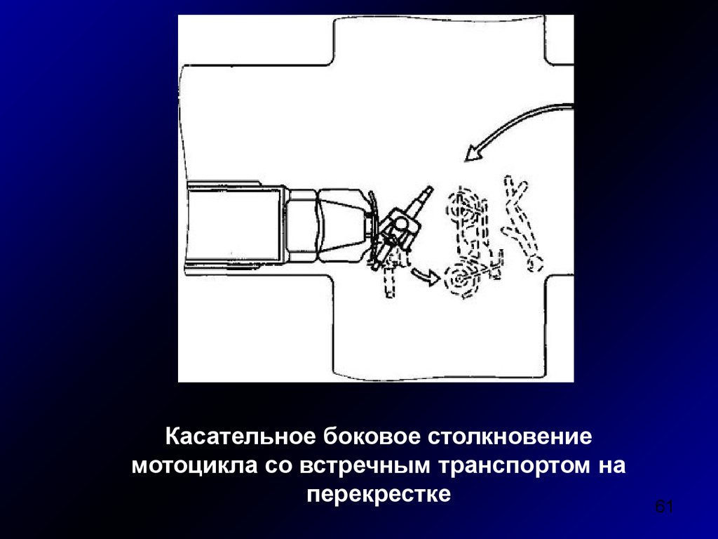 Железнодорожная травма презентация