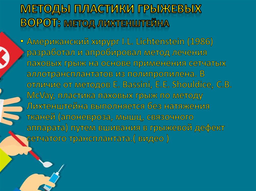 Методы пластики грыжевых ворот: метод Лихтенштейна
