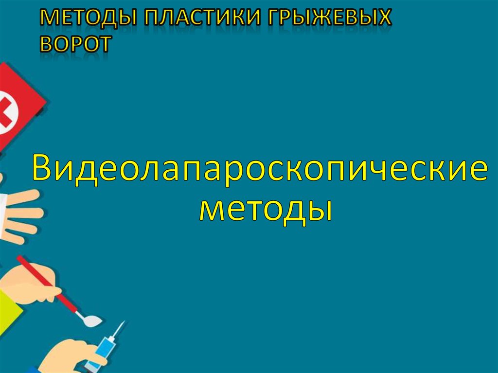 Методы пластики грыжевых ворот