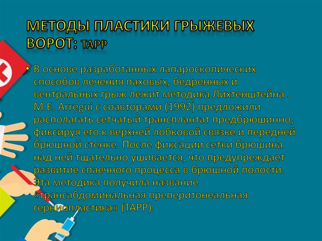 Методы пластики грыжевых ворот: ТАРР