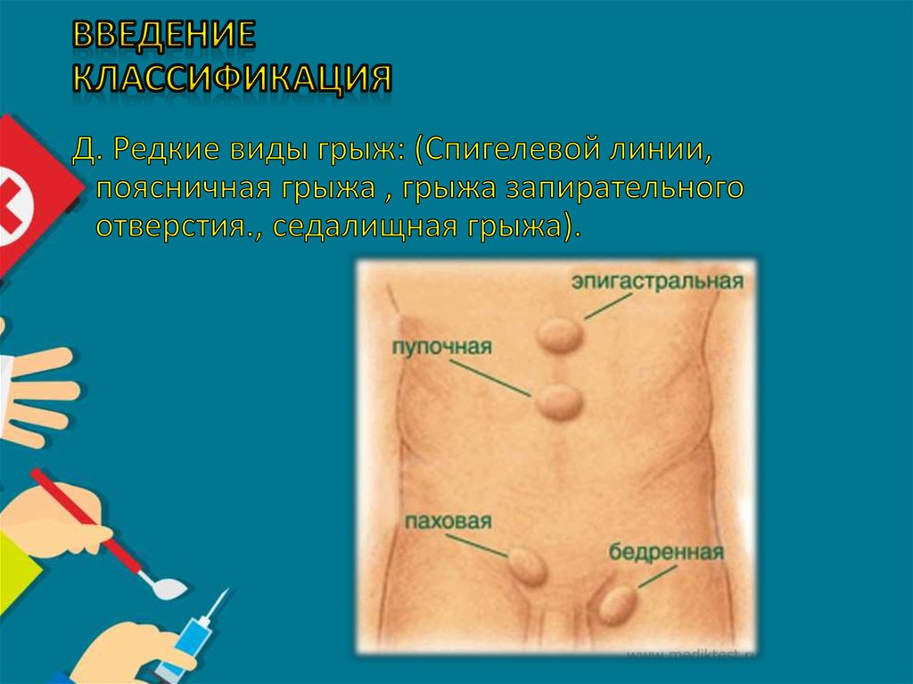 Введение классификация