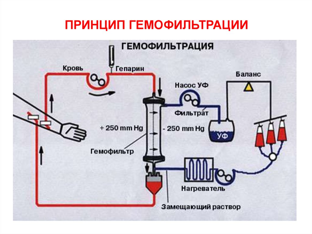 Диализ схема проведения