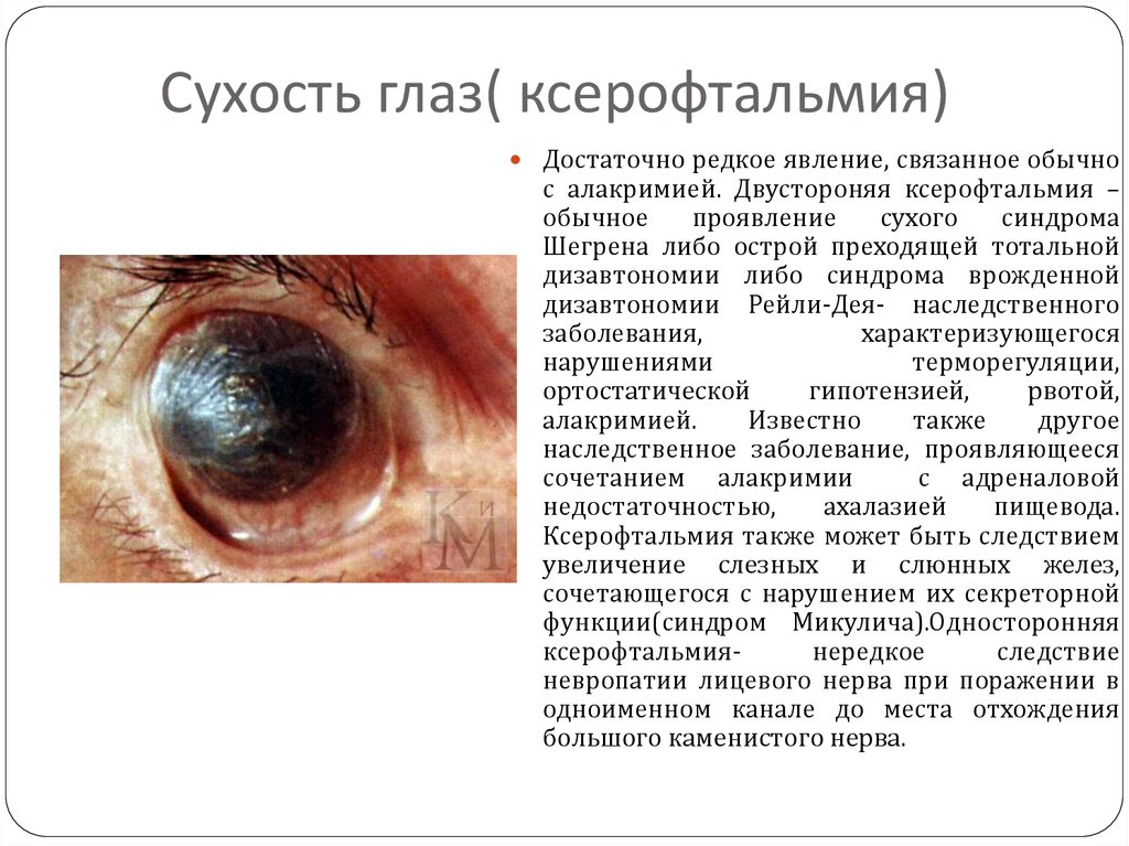 Сухость глаз( ксерофтальмия)