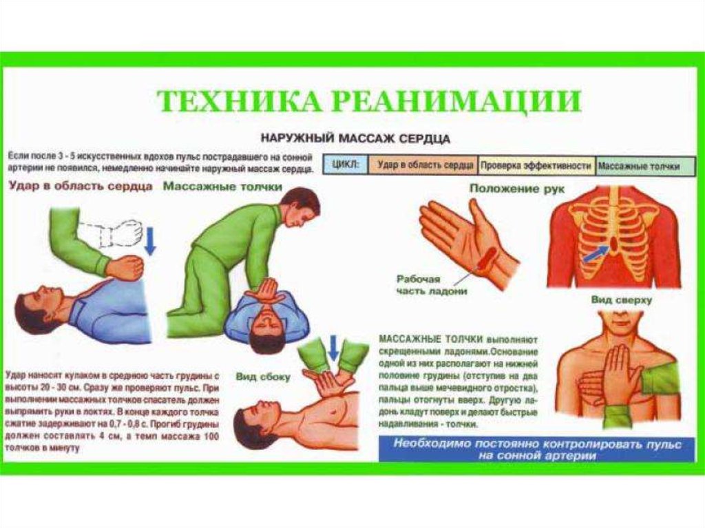 Оказание первой медицинской помощи массаж сердца. Сердечно-легочная реанимация при поражении электрическим током. Техника реанимации. Сердечно легочная реанимация плакат. Массаж сердца при поражении электрическим.