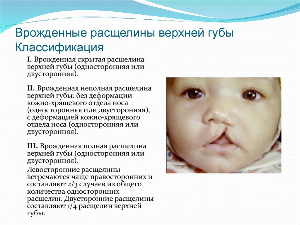 Реферат: Особенности структуры речевого дефекта у детей с врожденными расщелинами неба и губы