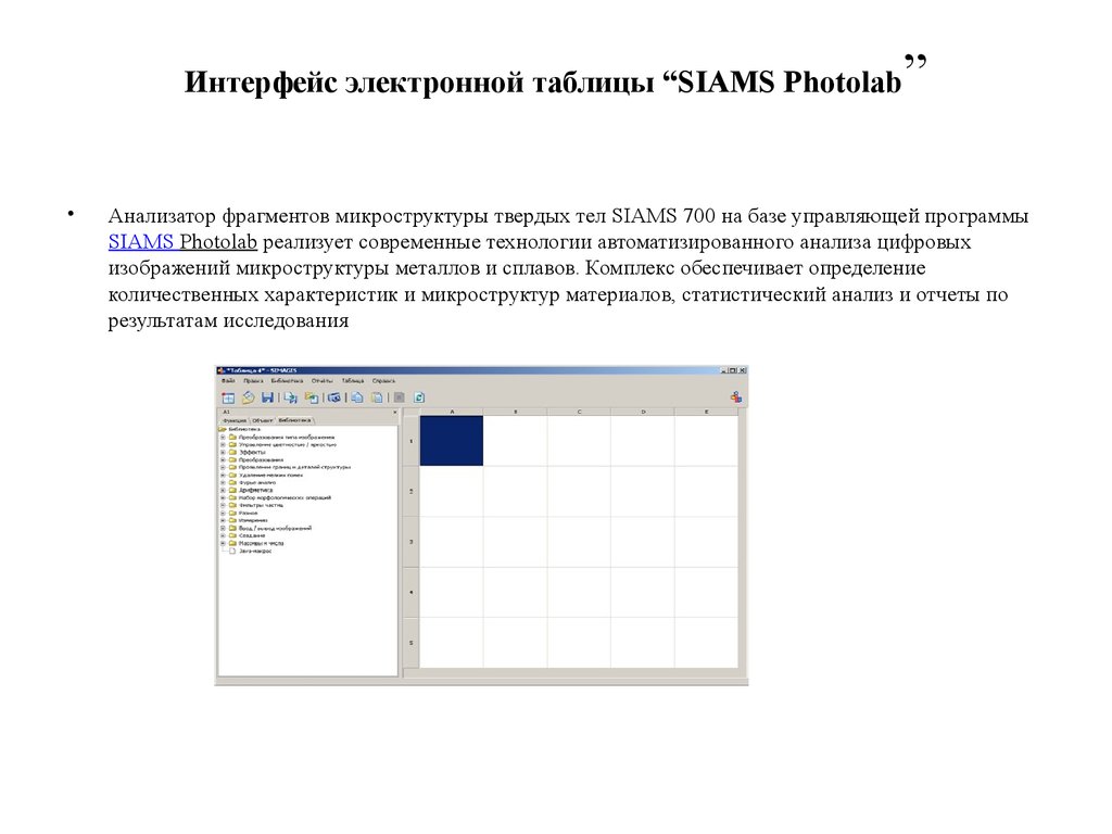 Siams 700 анализатор изображений